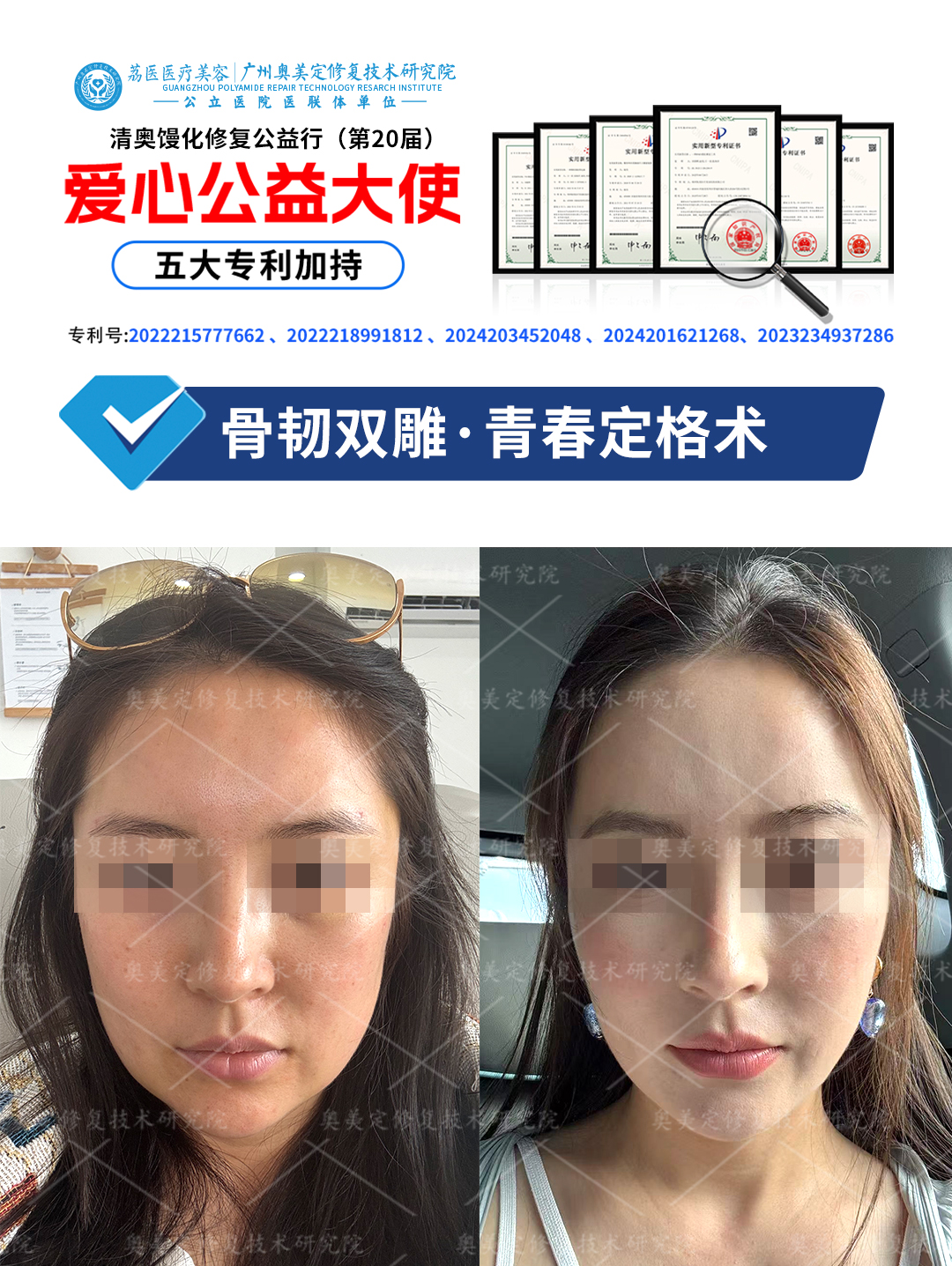 警惕！假玻尿酸毁脸有多可怕？