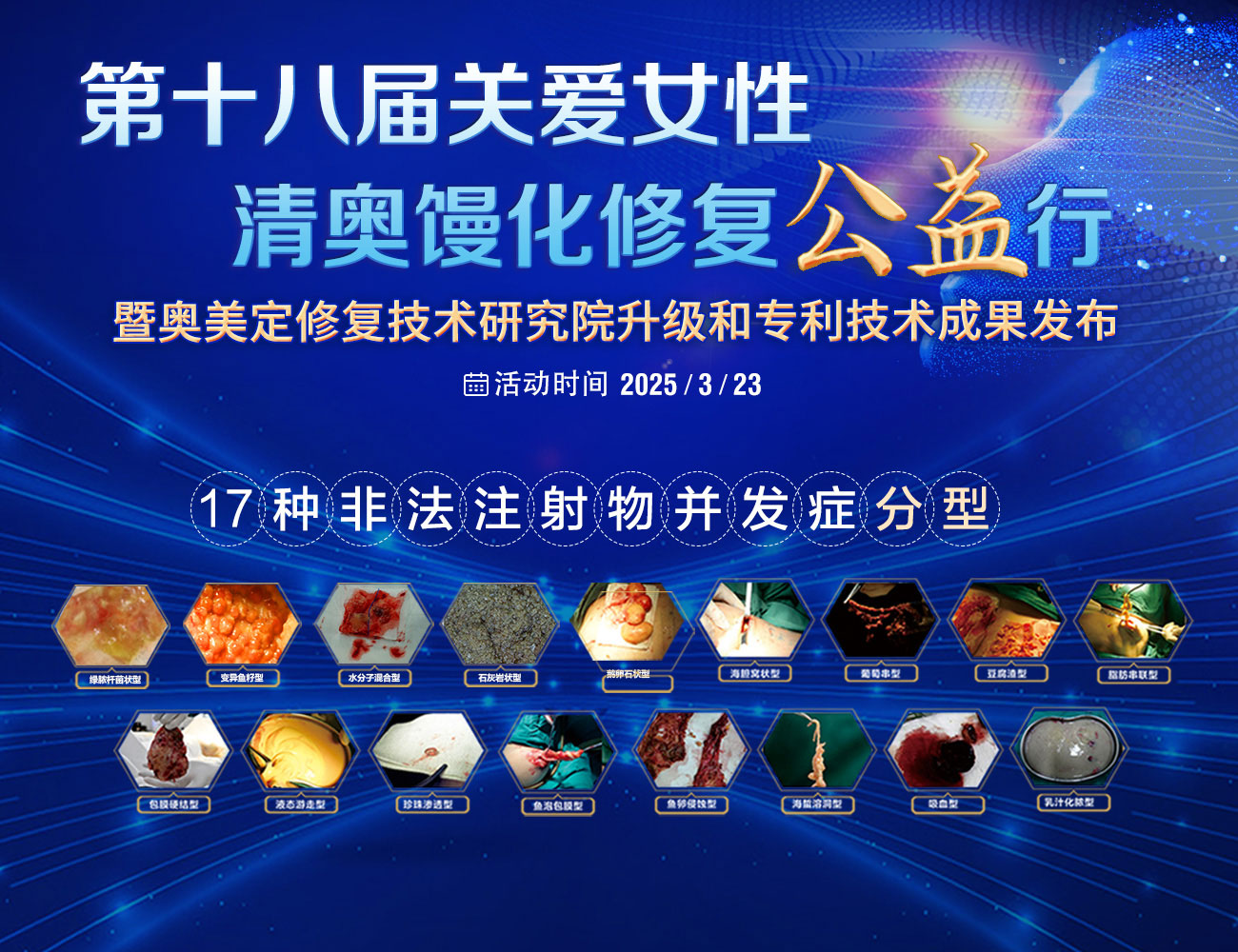 生长因子填充面部后如何取出？
