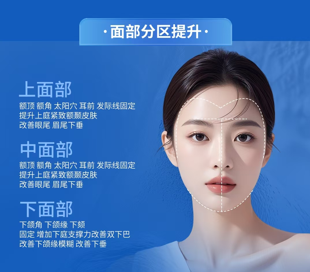 「面部分层复位提升术」 新品发布｜把年轻轮廓“钉”在脸上