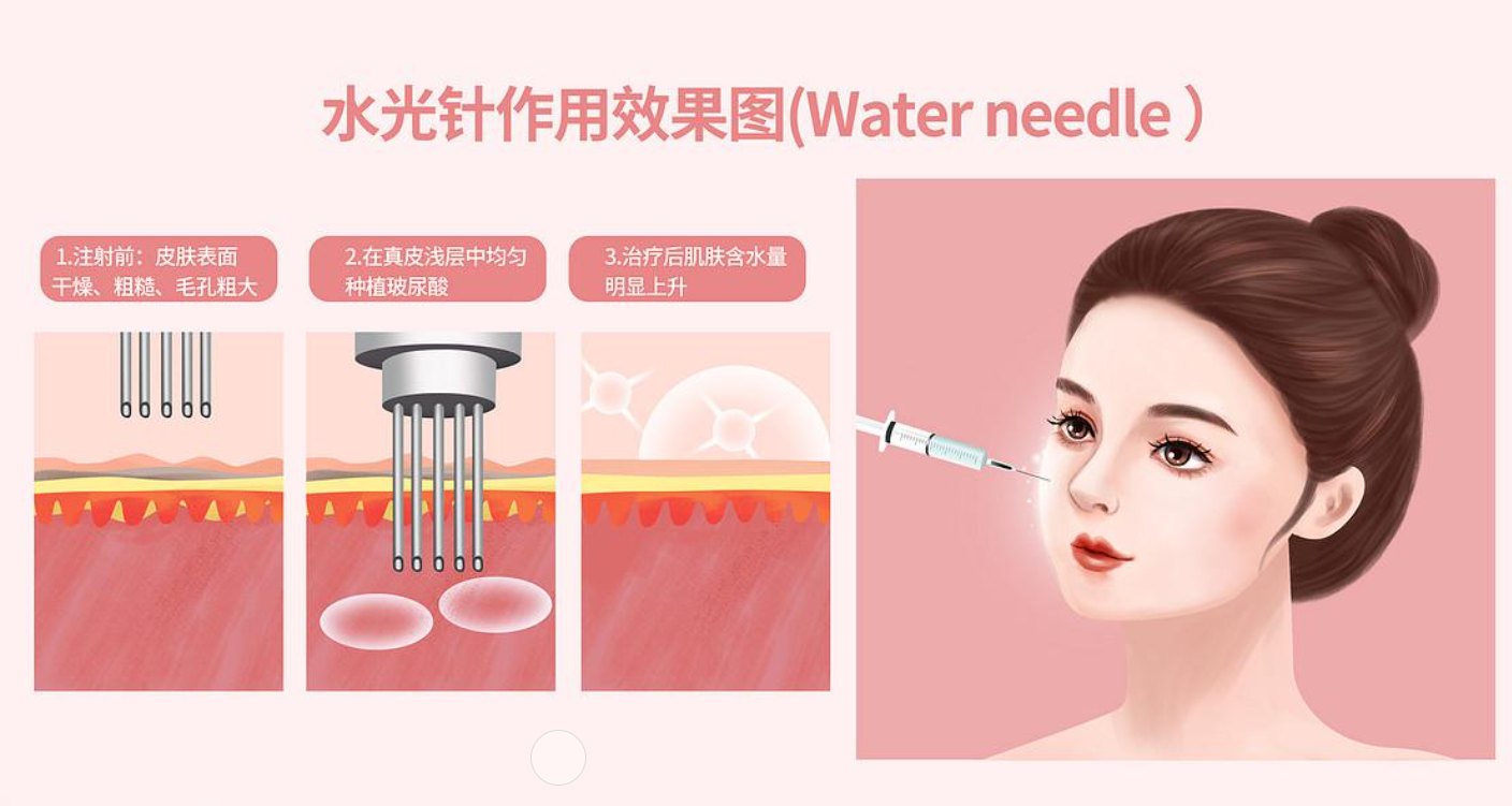 水光针多久打一次较好，皮肤无创医师教你如何科学保养不踩坑