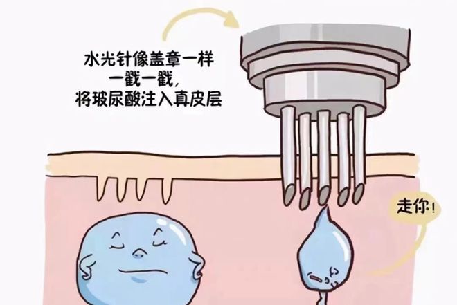 水光针注射有危险吗